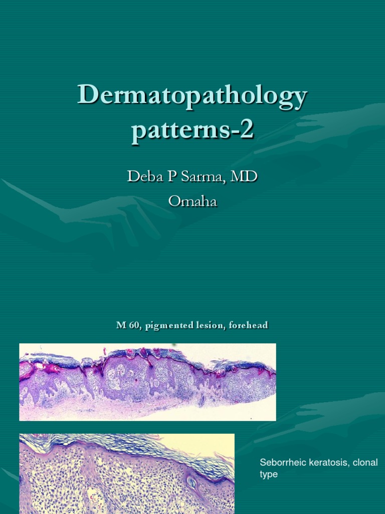 Dermatopathology Patterns 2 | PDF