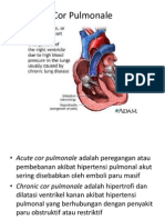 Penyakit Kelainan Jantung (Cor Pulmonale)