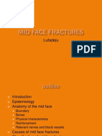 Mid Face Fracture