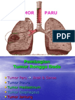 Tumor Paru Power Point
