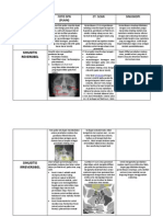 Tugas Sinusitis