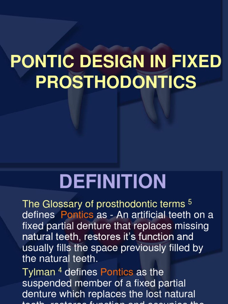 Pontic s Dental Composite Dentures