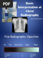 ABCDE Approach to Chest X-Ray Interpretation | PDF | Lung | Thorax