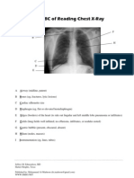 ABC of Reading Chest Xray