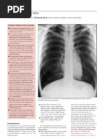 Chest X-Ray Interpretation Guide | PDF | Thorax | Lung