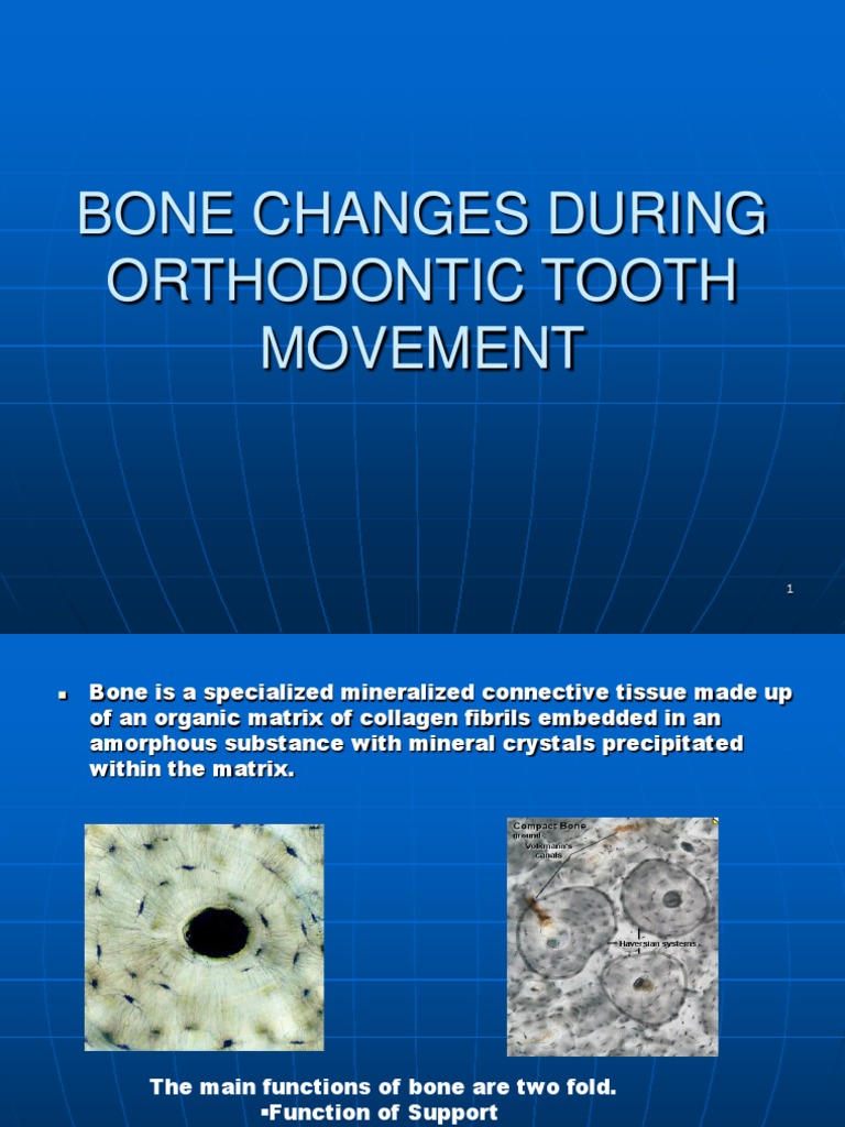 Bone Changes During Orthodontic Treatment Bone Osteoblast
