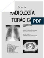 Radiología torácica normal