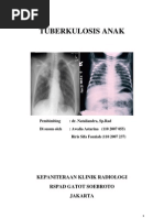 Download Referat - Tuberkulosis Pada Anak by Andi Alfian SN124912323 doc pdf