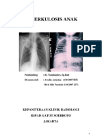 Download Referat - Tuberkulosis Pada Anak by Andi Alfian SN124912323 doc pdf