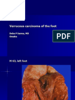 Verrucous Carcinoma of the Foot, M 63,Left Foot. PPT