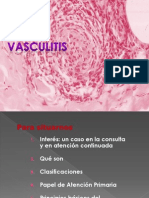 Vasculitis, Amiguis