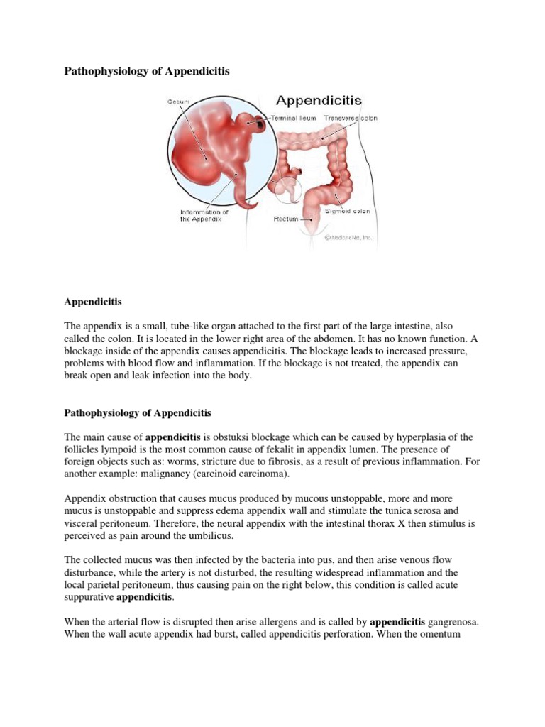 Pathophysiology of Appendicitis | PDF | Anatomy | Medical Specialties