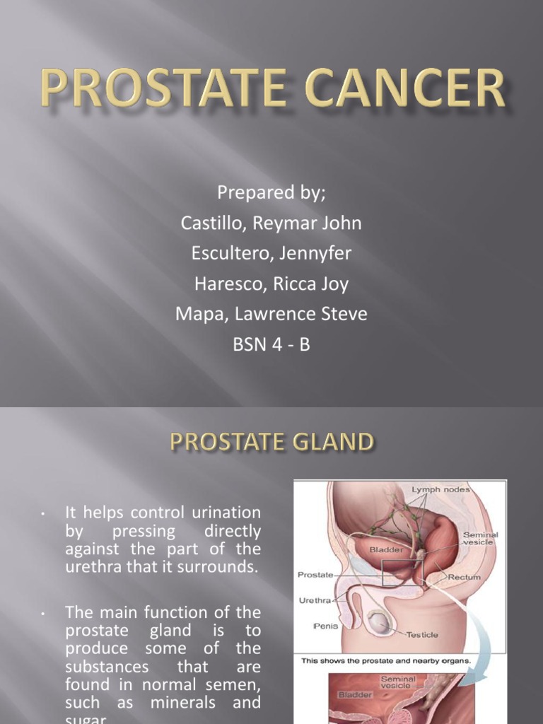 Prostate Cancer | PDF | Prostate Cancer | Prostate Specific Antigen