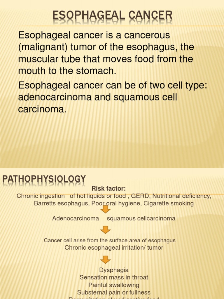 Esophageal CA | PDF | Esophagus | Esophageal Cancer