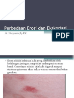 Perbedaan Erosi Dan Ekskoriasi