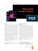 Enfermedad Vascular Cerebral