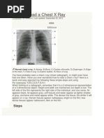 Chest X-Ray Interpretation Guide | PDF | Lung | Thorax
