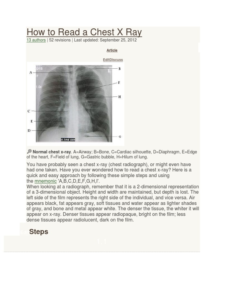 How to Read a Chest X-Ray Guide | PDF | Lung | Human Anatomy