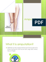 Amputation