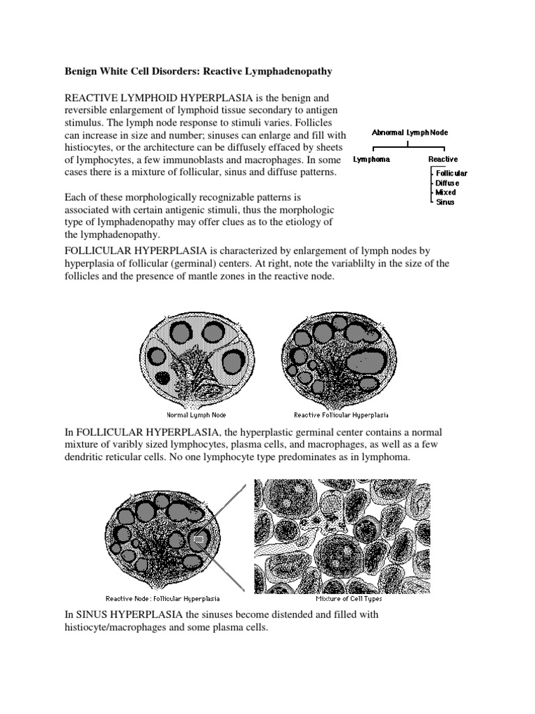Limfoid Hiperplasia | PDF | Lymphatic System | Lymph Node