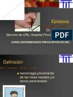 EPISTAXIS.ppt