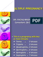 Multiple Pregnancy: Dr. Razaq Masha, Frcog Consultant, Ob/Gyn Dept