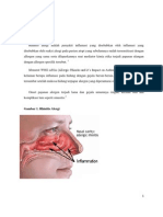 Rhinitis Alergi