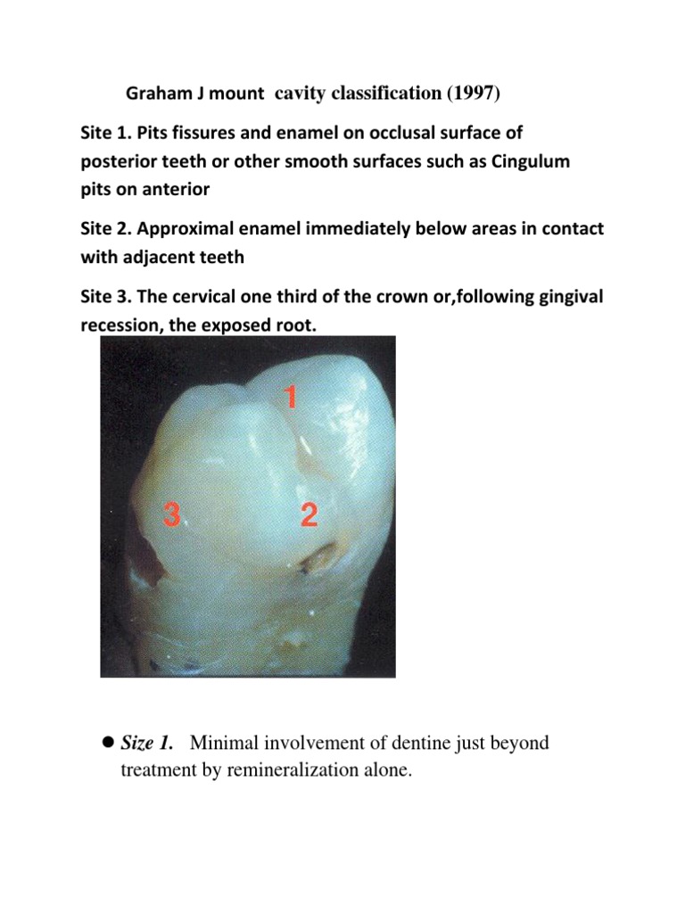 Mount Classification of Dental Caries | PDF