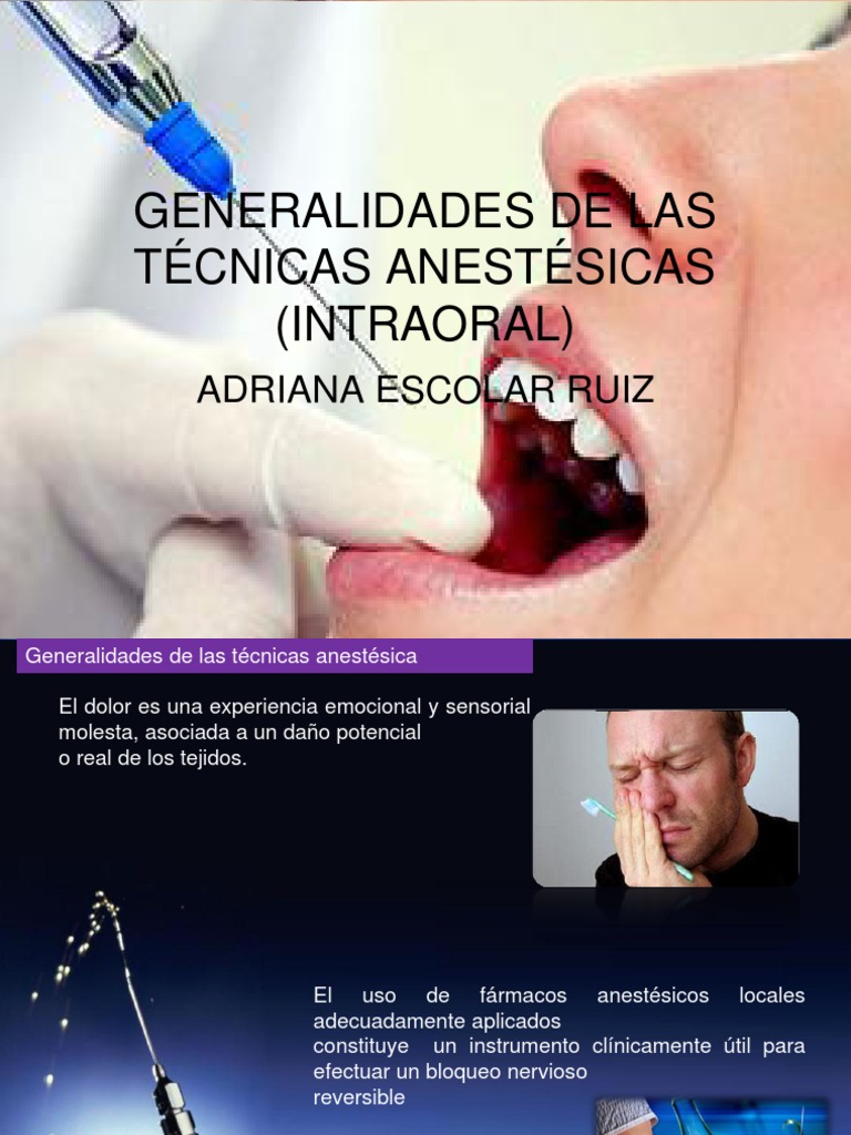 An Overview of Dental Local Anesthesia Techniques Infiltration, Nerve