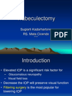 Trabeculectomy Procedure for Lowering Eye Pressure