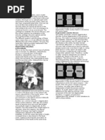 Download Arthritis by sarguss14 SN12690719 doc pdf