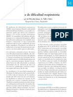 Sindrome de Dificultad Respiratoria