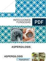 Infecciones Fungosas
