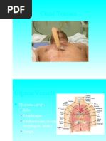 Download EMT Basic - Chest Trauma  by Paulhotvw67 SN12764520 doc pdf