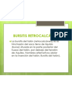 Bursitis Retrocalcánea