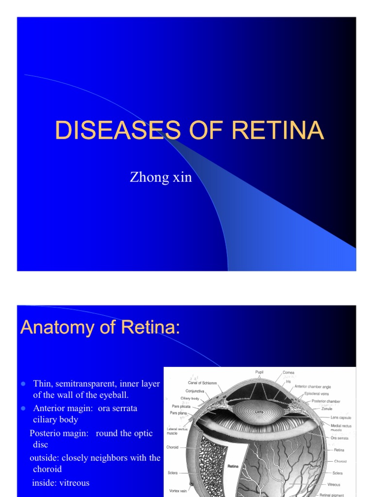 Diseases of Retina | PDF | Ophthalmology | Eye
