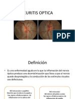 Neuritis Optica