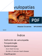 Valvulopatìas