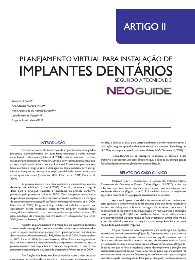 Artigo 02 Planejamento Virtual para Instalacao de Implantes Dentarios ...