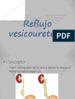 Reflujo Vesicoureteral