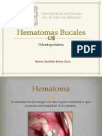 Hematomas Bucales