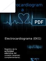 Electrocardiogram A