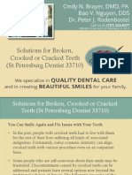 Solutions For Broken, Crooked or Cracked Teeth (ST Petersburg Dentist 33710)