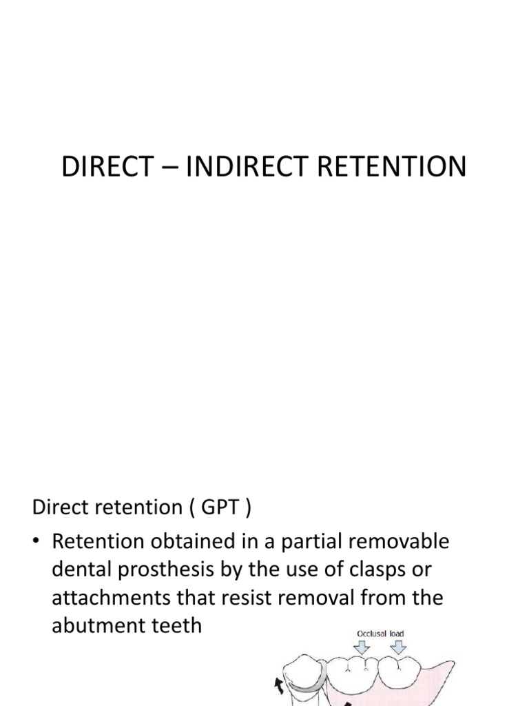 Direct and Indirect Retention in RPD | PDF