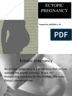 Ectopic Pregnancy: Prepared By: MADONA S. LAT