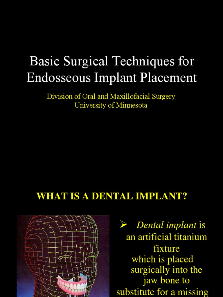 Basic implant lecture 2007.ppt Dental Implant Mouth