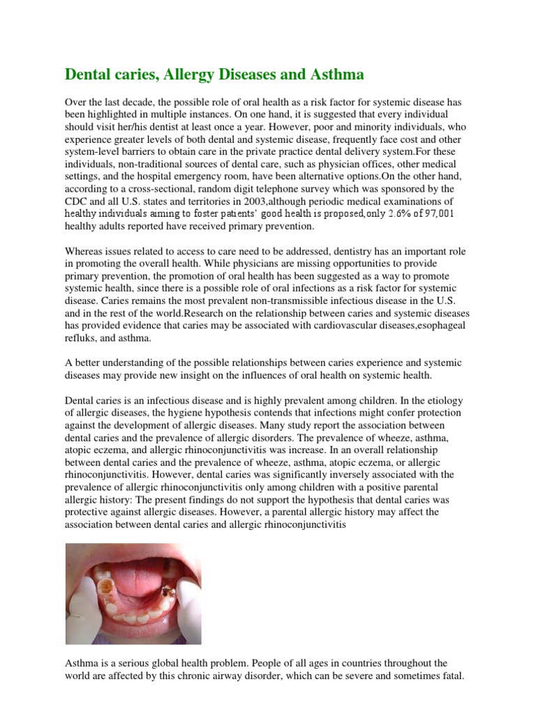 Dental Caries, Allergy Diseases and Asthma Allergy Dentistry