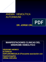 Anemia Hemolitica Autoinmune