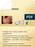 Terbakar dan melecur