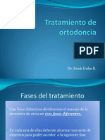 1º Fase Tratamiento de Ortodoncia